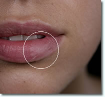 ヘルペス用パッチ